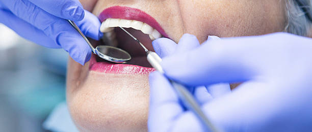 Best Emergency Dental Care for Abscessed Tooth in Myrtle Creek, OR